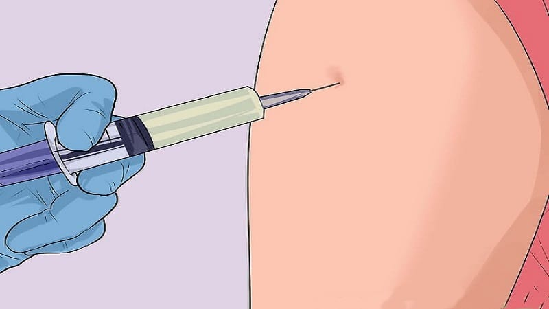 واکسن گارداسیل در بارداری