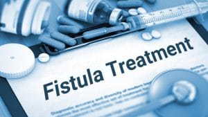 درمان دارویی فیستول، کاهش عفونت و آمادگی قبل از عمل جراحی
