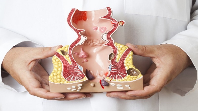 [تصویر:  anus-Health-Observation.jpg]