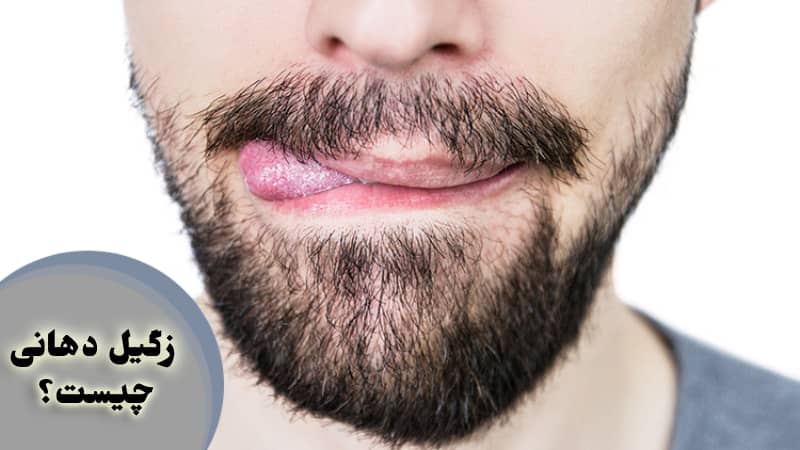 زگیل دهانی ؛ درمان و روشهای انتقال اچ پی وی از راه دهان