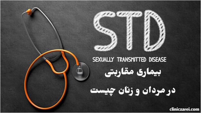12 بیماری مقاربتی -جنسی رایج زنان و مردان؛ علائم+ جلوگیری STDs