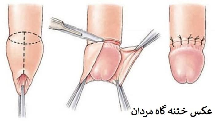 عکس چیز مرد واقعی + آلت تناسلی مردان + اندازه طبیعی آلت تناسلی مردان