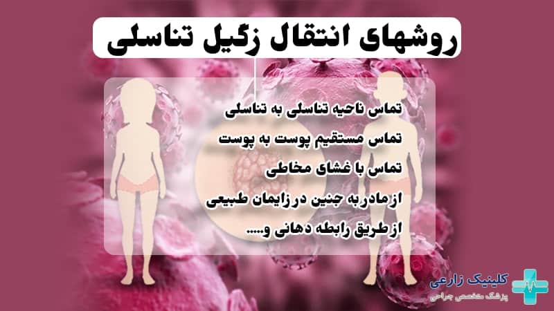 آیا HPV با یک‌ بار سکس منتقل می‌شود+ابتلا به ویروس HPV+ازمایش خون وHPV