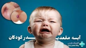 آبسه مقعدی در کودکان + درمان و دلایل ایجاد آن