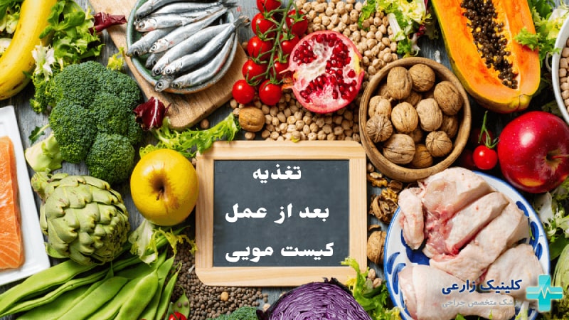 بعد از عمل کیست مویی چه بخوریم؟