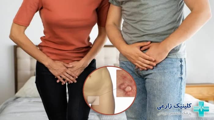 عکس از کجا بفهمیم زگیل تناسلی داریم