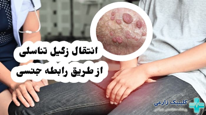 آیا HPV با یک‌ بار سکس منتقل می‌شود+ابتلا به ویروس HPV+ازمایش خون وHPV