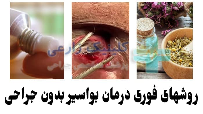 عکس درمان خانگی بیرون زدگی مقعدی