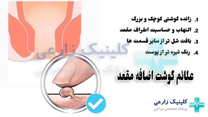 علت گوشت اضافه مقعدی زنان و مردان
