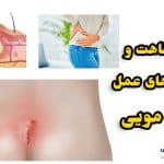 دوران نقاهت بعد از عمل کیست مویی | مرقبتهای بعد عمل