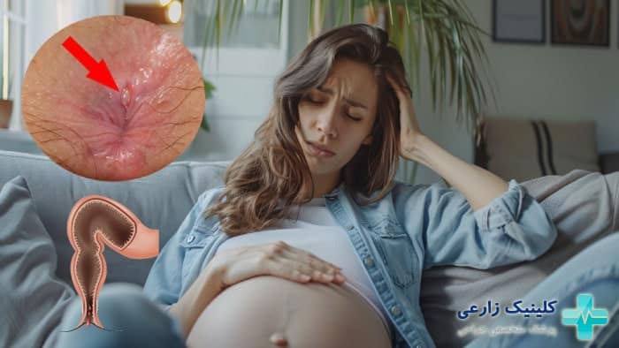 عکس خطرات زخم مقعد در حاملگی