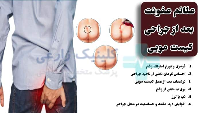 چه زمانی کیست مویی نیاز به جراحی دارد؟