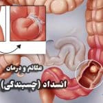 چسبندگی یا انسداد روده چیست و چه علائمی دارد| درمان و دلایل