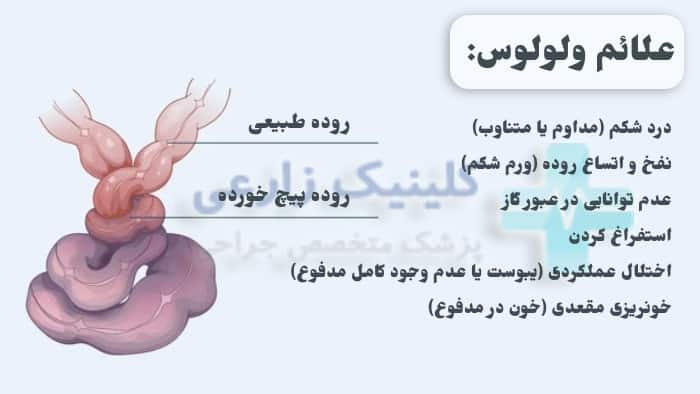 عکس علائم ولولوس چیست