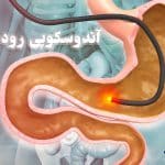 آندوسکوپی معده و روده چگونه انجام میشود | خطرات + مراقبتها