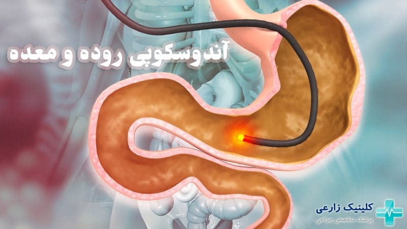 آندوسکوپی معده و روده چگونه انجام میشود | خطرات + مراقبتها