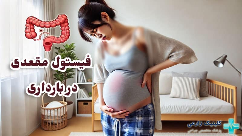 فیستول در بارداری | روشهای درمان و پیشگیری