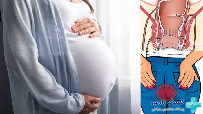 آیا فیستول بارداری خطرناک است