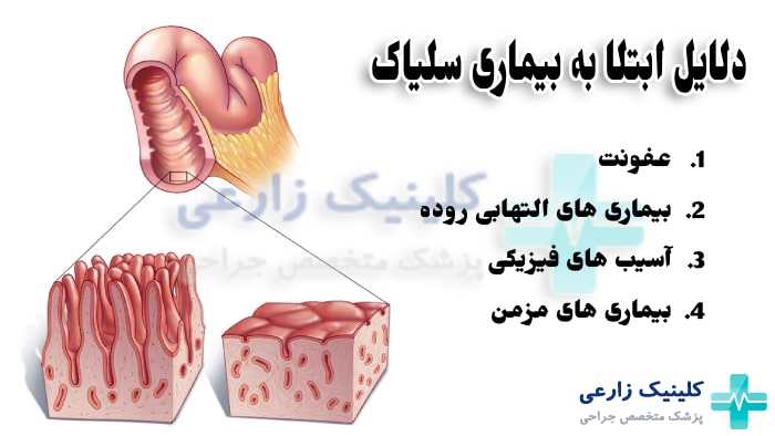 تصویر اینفوگرافیک از دلایل از بین رفتن پرز های روده