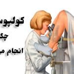 کولپوسکوپی چیست | نحوه انجام، کاربرد، هزینه و عوارض خطرناک