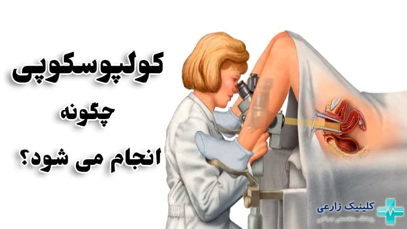 کولپوسکوپی چیست | نحوه انجام، کاربرد، هزینه و عوارض خطرناک