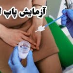 آزمایش پاپ اسمیر چیست | شرایط انجام و بهترین زمان تست پاپ