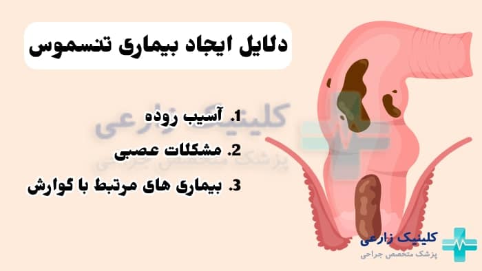 تصویر از علت بیماری تنسموس