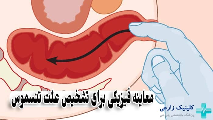 عکس از معاینه فیزیکی مقعد