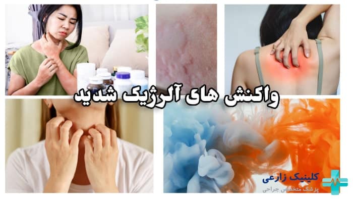 واکنش های آلرژیک به پماد بتامتازون چیست