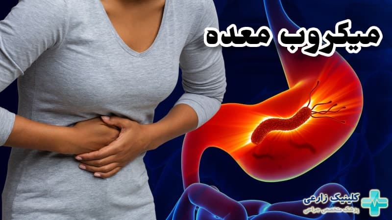 میکروب معده چیست | درمان قطعی با دارو گیاهی و قرص + تغذیه