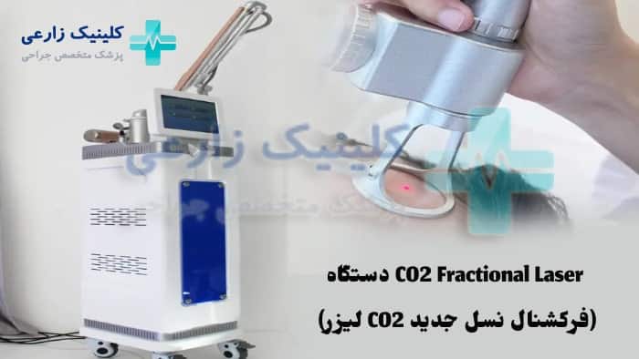 عکس دستگاه لیزر CO2 فرکشنال