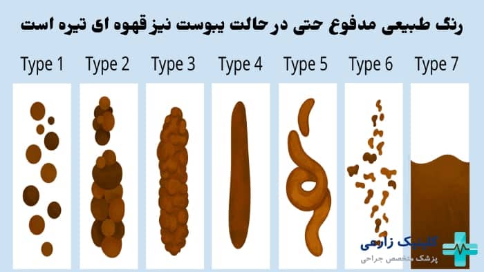 شکل رنگ طبیعی مدفوع