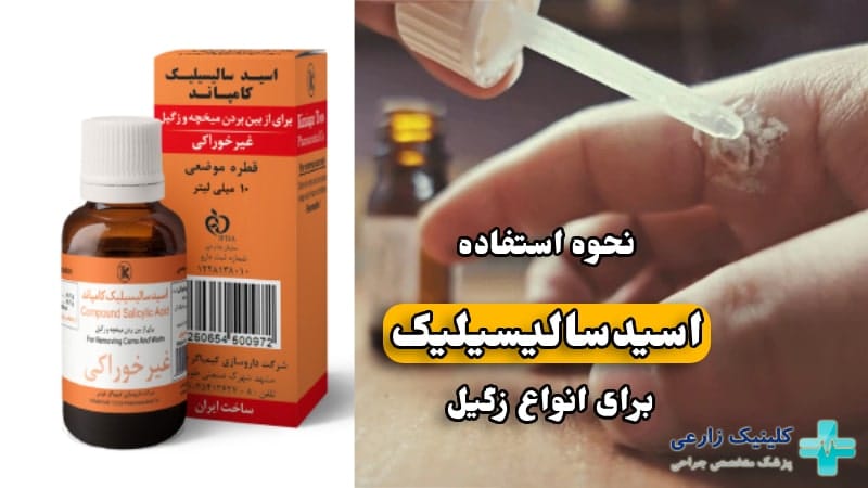 قیمت اسید سالیسیلیک برای زگیل تناسلی/قطره زگیل