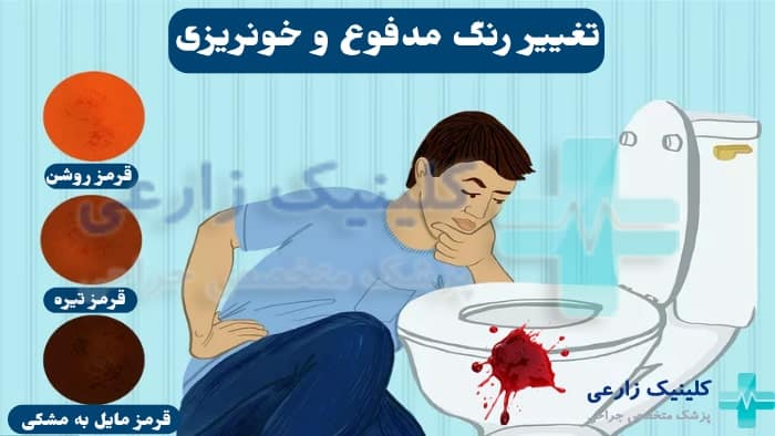 عکس تغییر رنگ مدفوع به دلیل خونریزی گوارشی