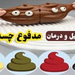 مدفوع چسبناک چه علتی دارد؟ درمان چسبندگی مدفوع چگونه است؟