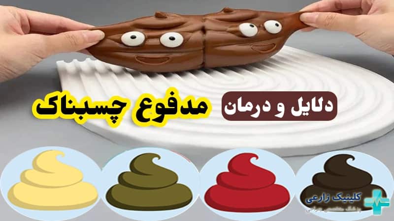 مدفوع چسبناک چه علتی دارد؟ درمان چسبندگی مدفوع چگونه است؟