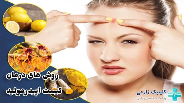 عکس روش های درمان کیست اپیدرمال سباسه