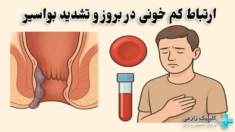 ارتباط کم‌ خونی در بروز و تشدید هموروئید (بواسیر)