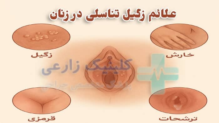 علائم زگیل تناسلی در زنان عکس