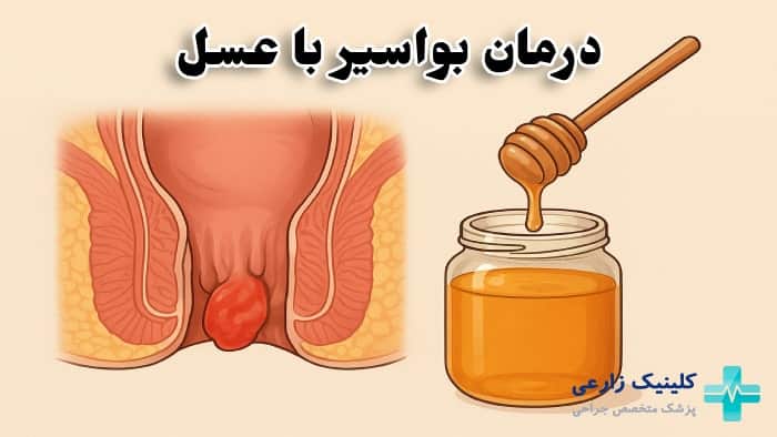 عکس درمان بواسیر با عسل