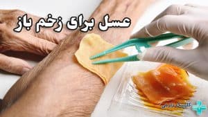 طریقه مصرف عسل برای زخم باز | مراحل ترمیم + خواص و عوارض