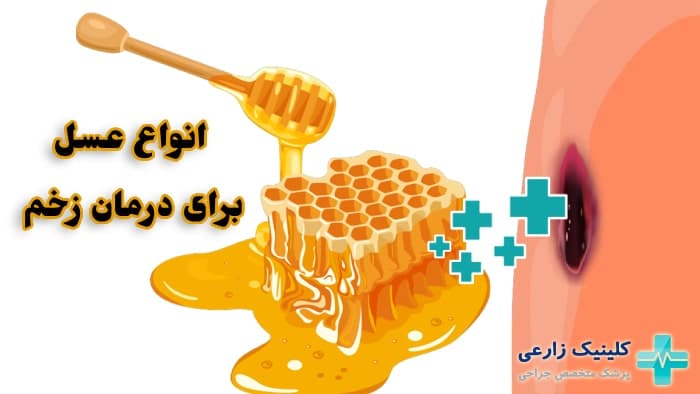 عکس انواع عسل برای درمان زخم