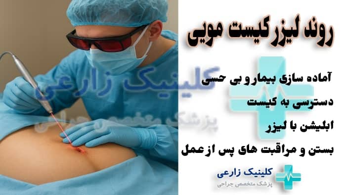عکس مراحل لیزر کیست مویی در کلینیک دکتر علیرضا زارعی