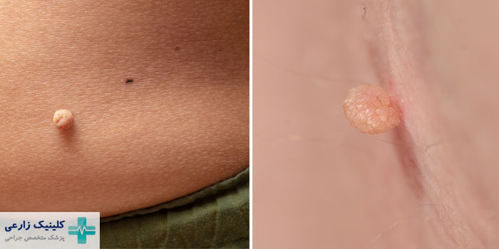 انواع اسکین تگ