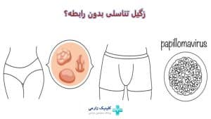 علت زگیل تناسلی بدون رابطه | پیشگیری از انتقال غیر جنسی hpv